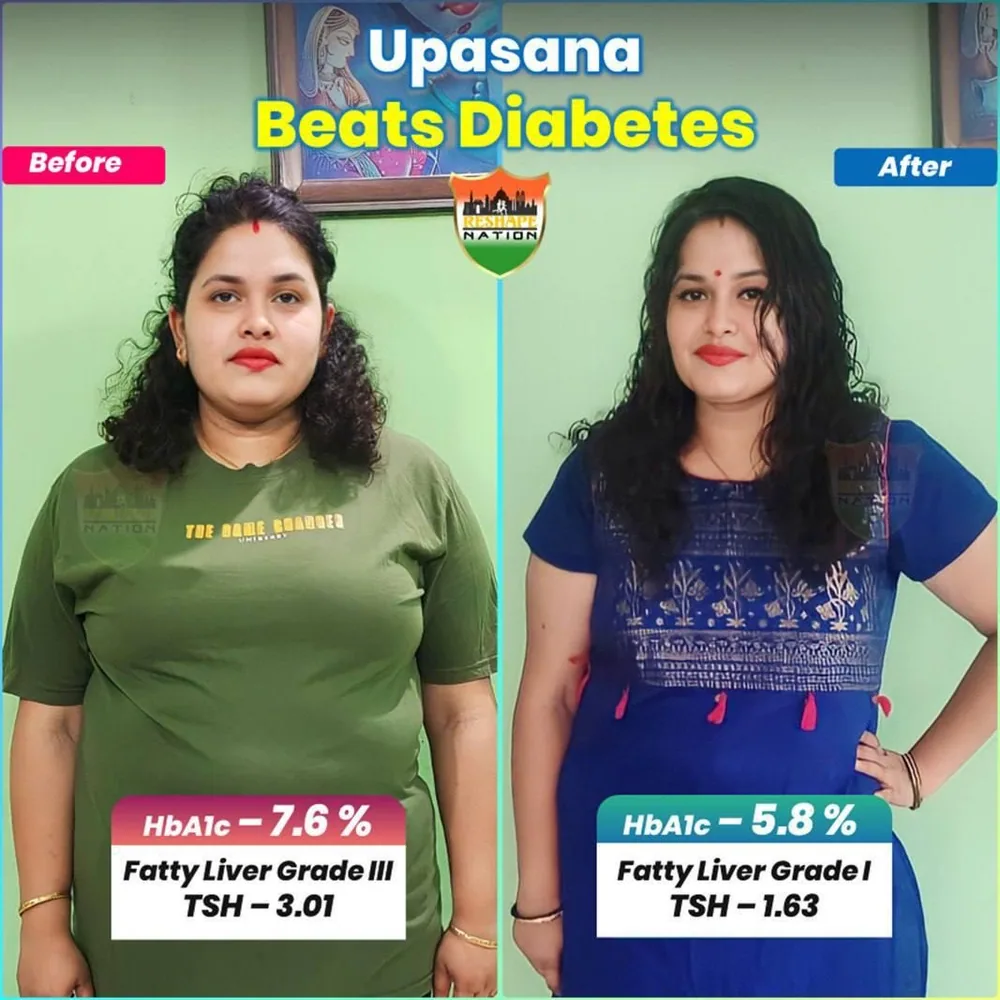 Upasana Bhaishya — transformation